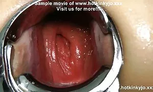 Bapolisi ya bankento ...